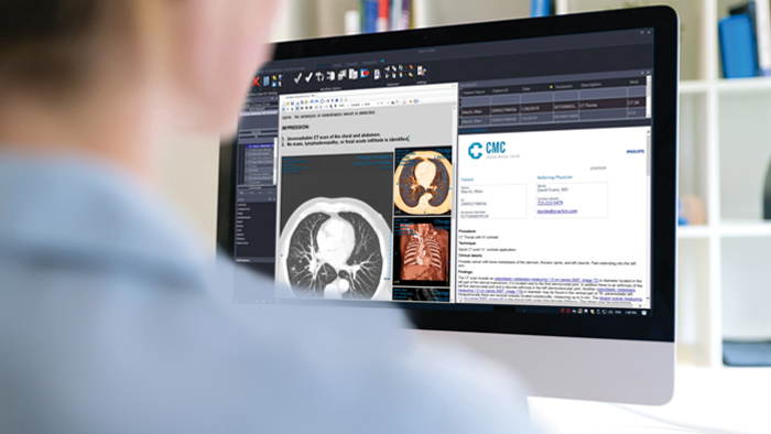 Informar y comunicar resultados